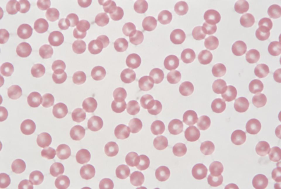 A microscope view of many round, pale-red blood cells, each lighter in the centre.