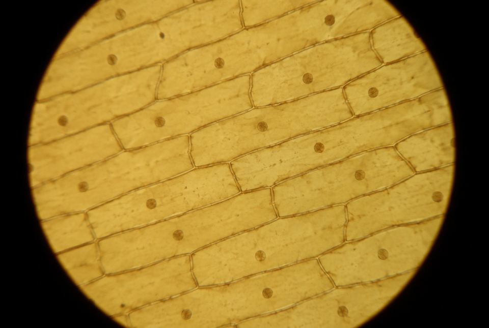 Onion skin cells stained with iodine, seen through a light microscope as rows of long brick-shaped cells, each with a dark dot.
