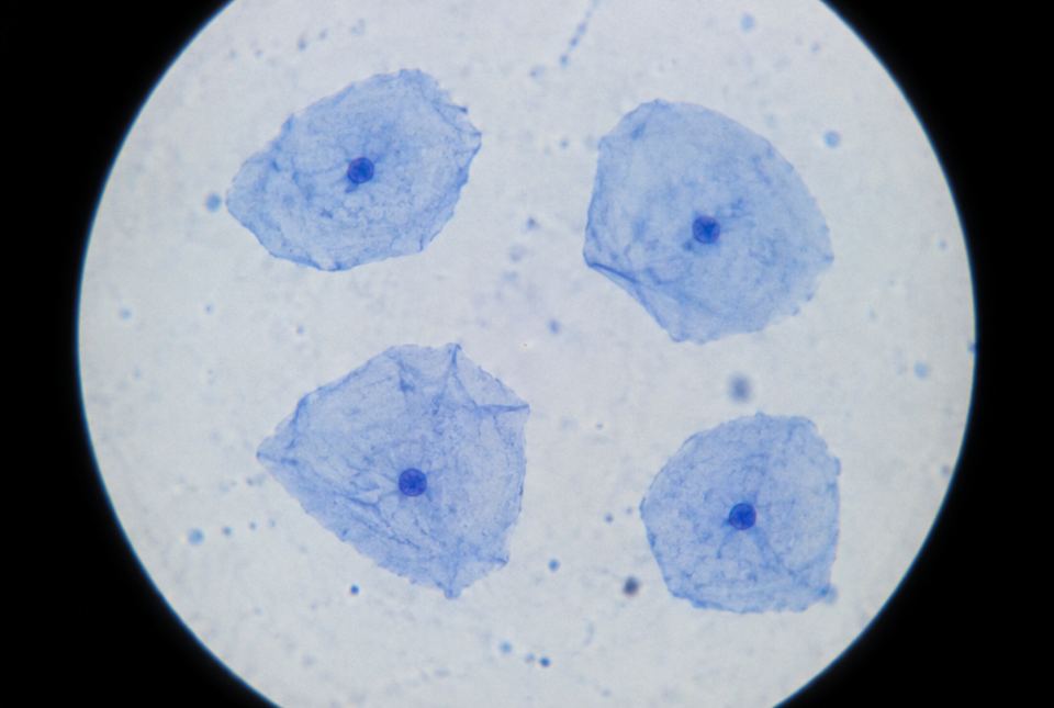 Four flat, irregular cheek cells stained blue, each with a small dark nucleus, seen through a light microscope.